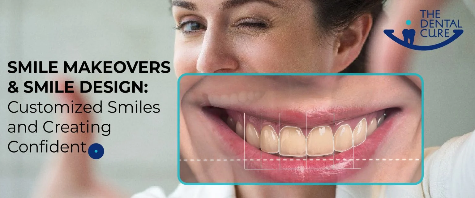Smile Design vs Smile Makeover â€“ Key Differences