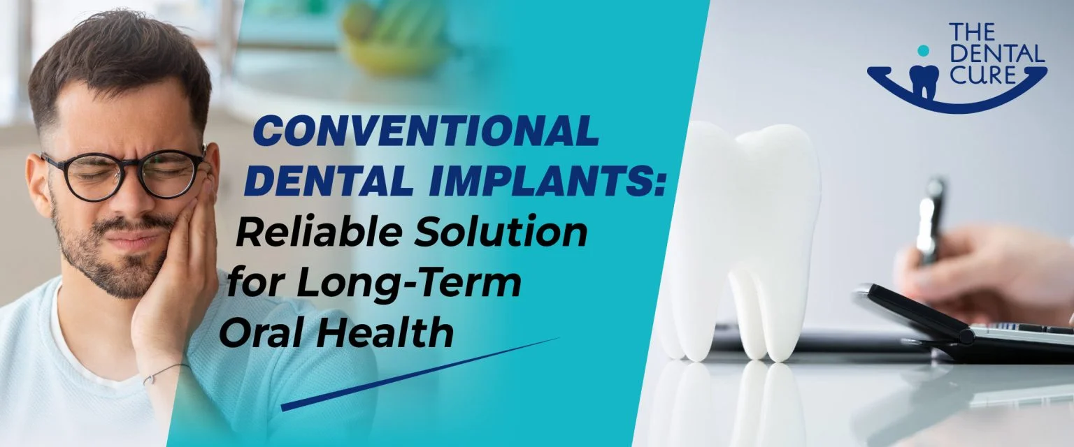 Conventional Dental Implants: Reliable Solution for Long-Term Oral Health