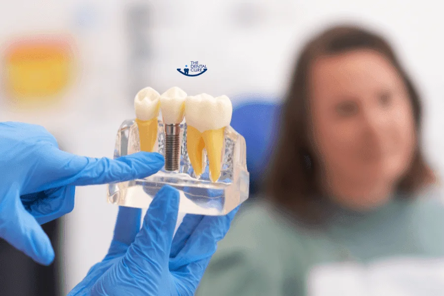 Dental Implants in Gurgaon â€“ Cost, Procedure & Best Clinic