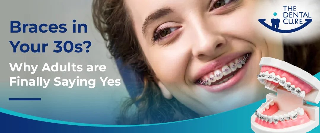 Braces in Your 30s? Why Adults Are Finally Saying Yes