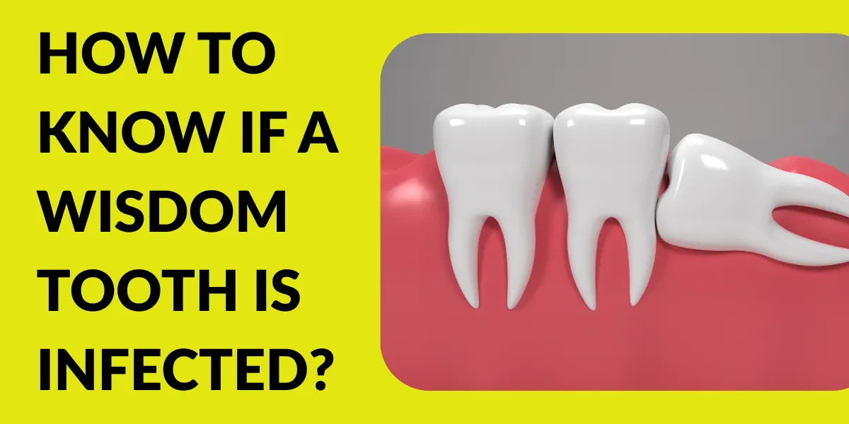 How to Know If a Wisdom Tooth is Infected