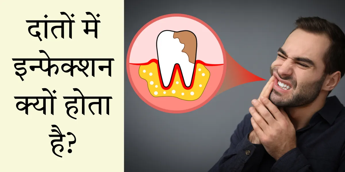 What are the Three Types of Dental Implants?