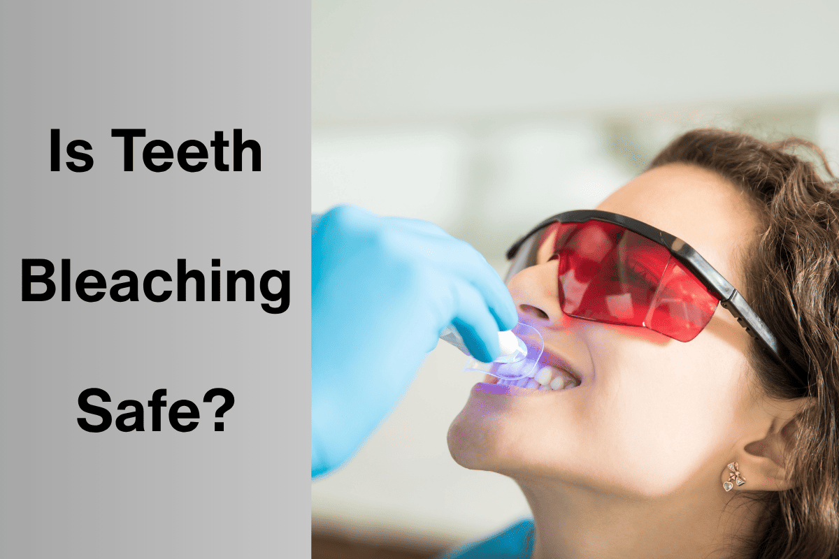 Is Teeth Bleaching Safe?