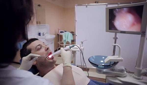 Intra Oral Camera Image 1