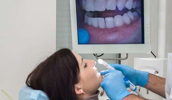 Intra Oral Camera Image 2