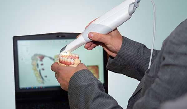 Itero 3D Intraoral Scanner Image 2