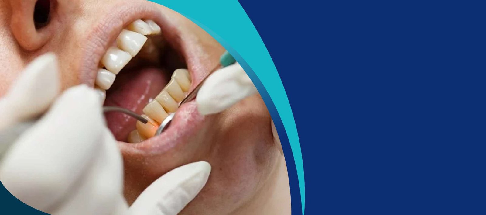 Lasers Hard and Soft Tissues Background