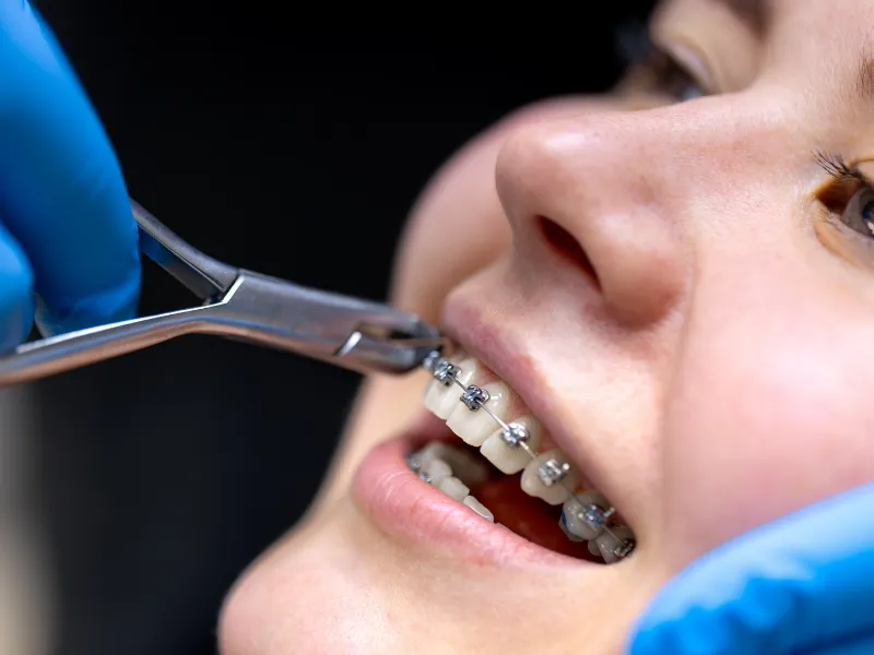 Orthodontist in Gurgaon