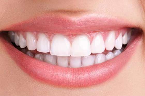 After Teeth Whitening / bleaching