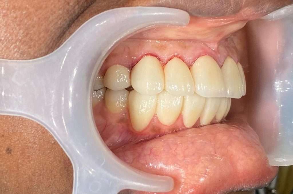 Smile Designing Dental Clinic in Gurgaon