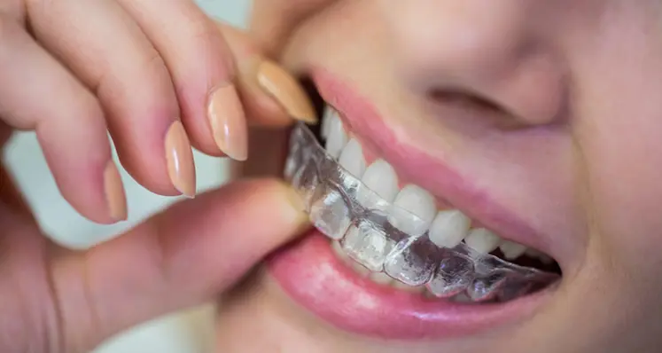Invisalign Treatment in Gurgaon