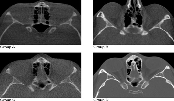 cbct-for-ct-of-bone-01