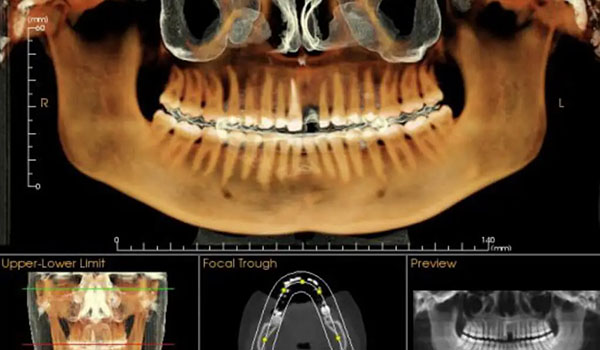 cbct-for-ct-of-bone-02