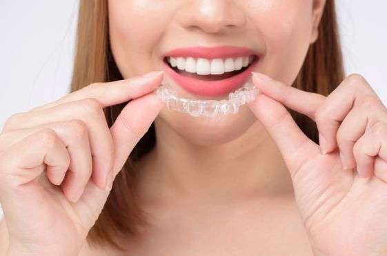 Invisalign Treatment in India