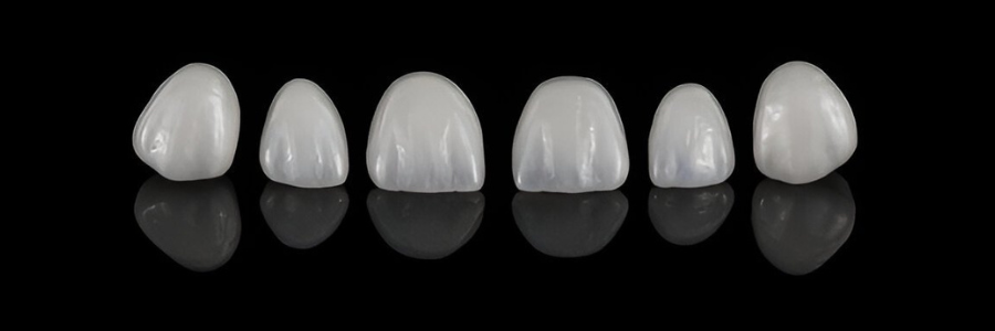 All-Ceramic Crowns / Zirconia Crowns