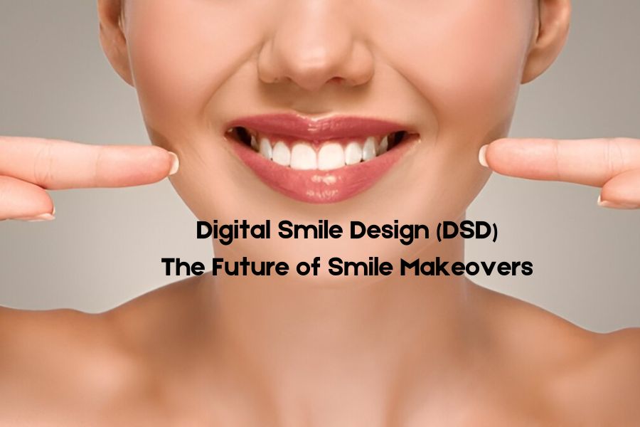 Digital Smile Design (DSD) – The Future of Smile Makeovers