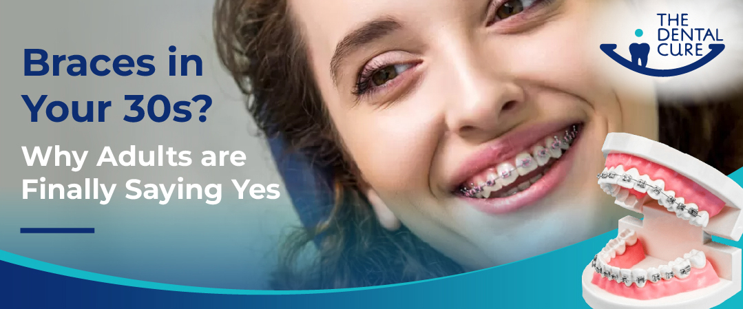 braces
